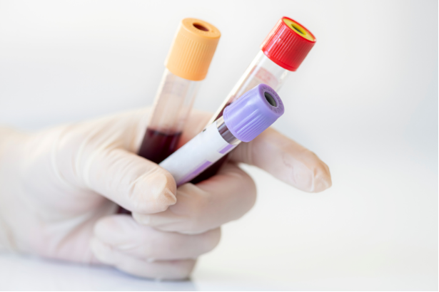 Lab Testing in Morrisville & West Cary, NC | McCrimmon PCP